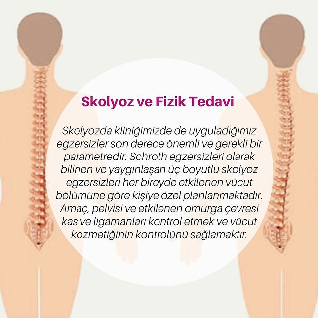 skolyoz